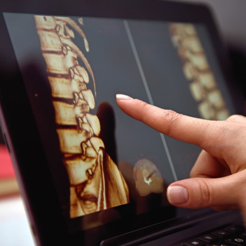 DÚVIDAS COMUNS SOBRE A COLUNA E DORES RELACIONADAS